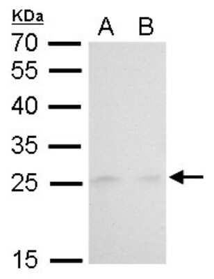 Western Blot: MAD2L1 Antibody (1761) [NBP2-43820]