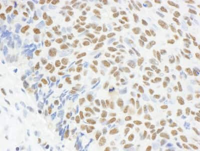 Immunohistochemistry: MAD2L1 Antibody [NB100-563]