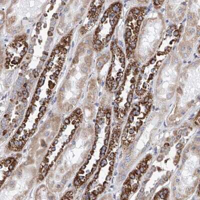 Immunohistochemistry-Paraffin: MAD2L1 Antibody [NBP1-83185]