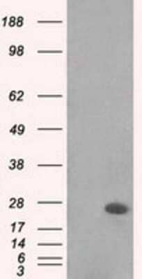 Western Blot: MAD2L1 Antibody (OTI4D2)Azide and BSA Free [NBP2-72565]