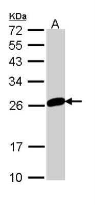 Western Blot: MAD2L1 Antibody [NBP1-33529]