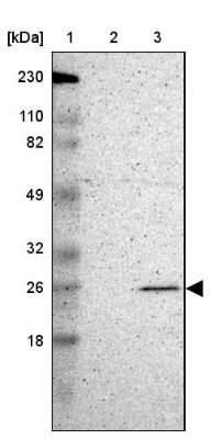 Western Blot: MAD2L1 Antibody [NBP1-83185]