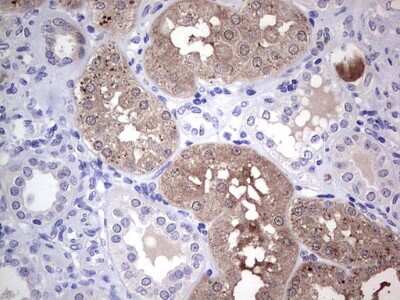 Immunohistochemistry: MAD2L1-binding protein Antibody (OTI3C11) [NBP2-45705]