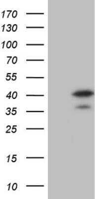 Western Blot: MAD2L1-binding protein Antibody (OTI3C11) [NBP2-45705]