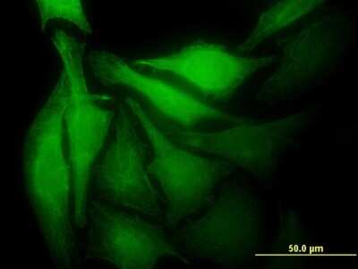 Immunocytochemistry/ Immunofluorescence: MAD2L1-binding protein Antibody (4G11) [H00009587-M03]