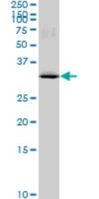 Western Blot: MAD2L1-binding protein Antibody (4G11) [H00009587-M03]