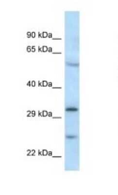 Western Blot: MAD2L1-binding protein Antibody [NBP1-79887]
