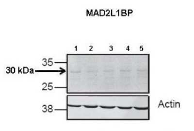 Western Blot: MAD2L1-binding protein Antibody [NBP1-79887]