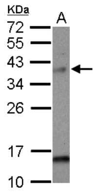 Western Blot: MAD2L1-binding protein Antibody [NBP2-17199]