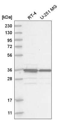 Western Blot: MAD2L1-binding protein Antibody [NBP2-55414]