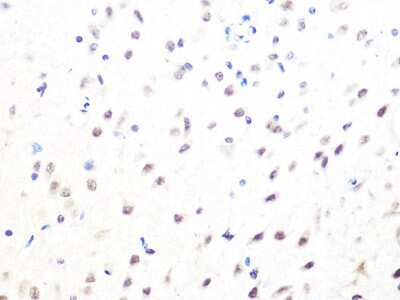 Immunohistochemistry-Paraffin: MAD2L2 Antibody (7B6I2) [NBP3-16451]