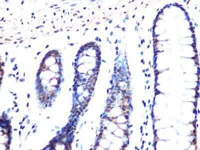 Immunohistochemistry-Paraffin: MAD2L2 Antibody (7B6I2) [NBP3-16451]
