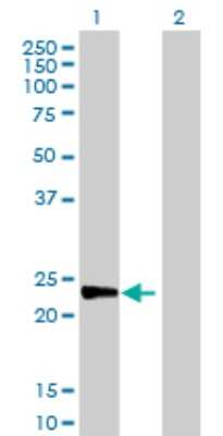 Western Blot: MAD2L2 Antibody [H00010459-D01P]