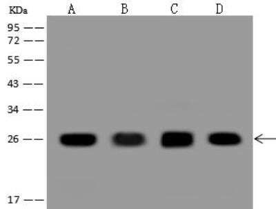 Western Blot: MAD2L2 Antibody [NBP3-12688]