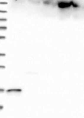 Western Blot: MAD2L2 Antibody [NBP3-17735]