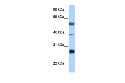 Western Blot: MAD3 Antibody [NBP2-87765]