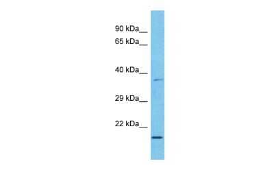 Western Blot: MAD3 Antibody [NBP2-87766]