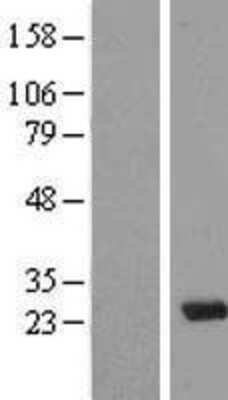 Western Blot: MAD3 Overexpression Lysate [NBL1-13407]