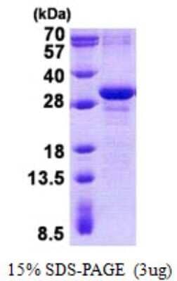 SDS-PAGE: Recombinant Human MAD3 His Protein [NBP2-23219]