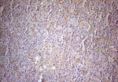 Immunohistochemistry: MAD4 Antibody (OTI7F7) - Azide and BSA Free [NBP2-72567]