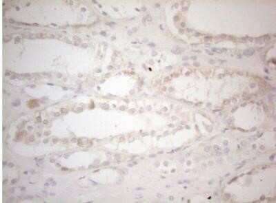 Immunohistochemistry: MAD4 Antibody (OTI7F7) - Azide and BSA Free [NBP2-72567]