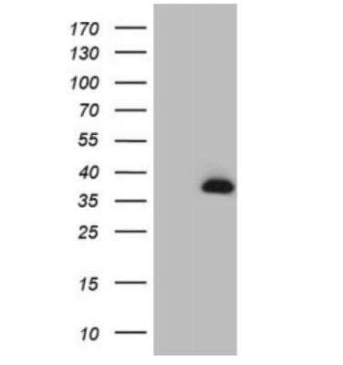 Western Blot: MAD4 Antibody (OTI7F7)Azide and BSA Free [NBP2-72567]