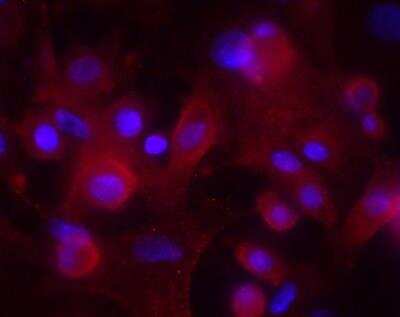 Immunocytochemistry/ Immunofluorescence: MAD4 Antibody (OTI7F7) [NBP2-46060]