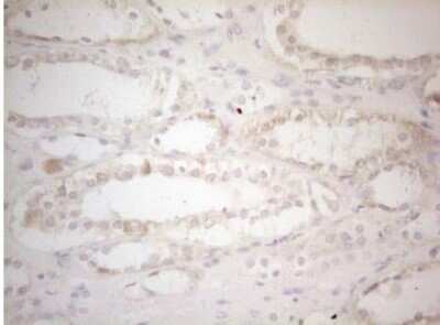 Immunohistochemistry-Paraffin: MAD4 Antibody (OTI7F7) [NBP2-46060]