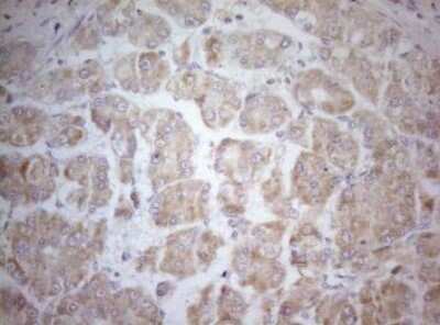 Immunohistochemistry-Paraffin: MAD4 Antibody (OTI7F7) [NBP2-46060]
