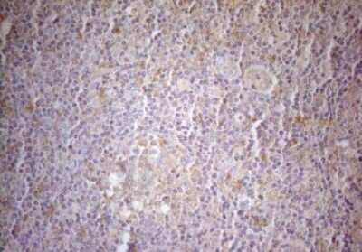 Immunohistochemistry-Paraffin: MAD4 Antibody (OTI7F7) [NBP2-46060]