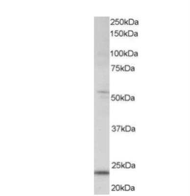 Western Blot: MAD4 Antibody [NB100-1117]