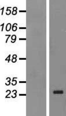 Western Blot: MAD4 Overexpression Lysate [NBP2-10411]