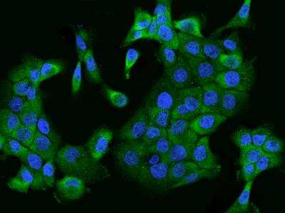 Immunocytochemistry/ Immunofluorescence: MADD Antibody [NBP3-06250]