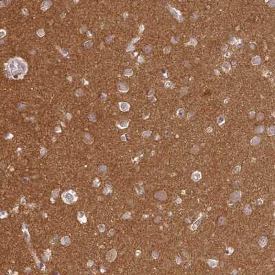 Immunohistochemistry-Paraffin: MADD Antibody [NBP1-85258]