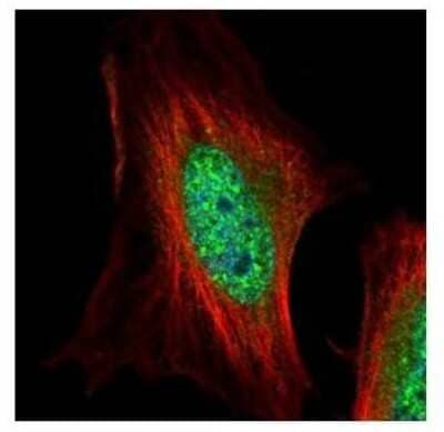 Immunocytochemistry/ Immunofluorescence: EMP/MAEA Antibody [NBP2-17200]