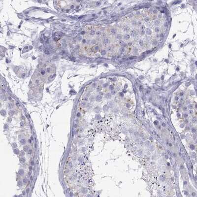 Immunohistochemistry-Paraffin: MAEL Antibody [NBP2-69070]