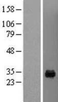 Western Blot: MAF1 Overexpression Lysate [NBL1-12793]