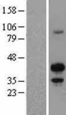 Western Blot: MafB Overexpression Lysate [NBL1-12794]