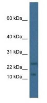 Western Blot: MafK Antibody [NBP1-79223]