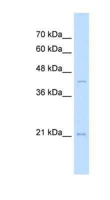 Western Blot: MafK Antibody [NBP1-79224]