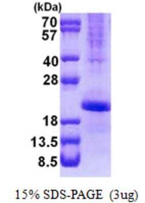 SDS-PAGE: Recombinant Human MafK His Protein [NBP2-22942]