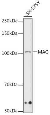 Western Blot: MAG/Siglec-4a Antibody (8Q7K5) [NBP3-16859]