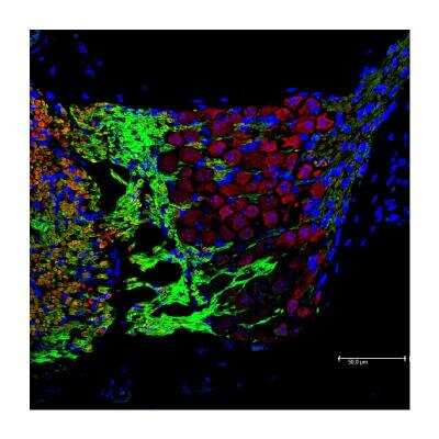 Immunohistochemistry-Paraffin: MAG/Siglec-4a Antibody [NBP1-81817]