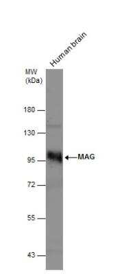 Western Blot: MAG/Siglec-4a Antibody [NBP2-17201]