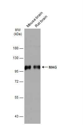 Western Blot: MAG/Siglec-4a Antibody [NBP2-17201]