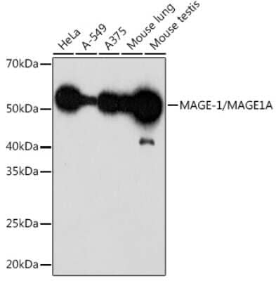 Western Blot: MAGEA1 Antibody (9Y6K1) [NBP3-15301]