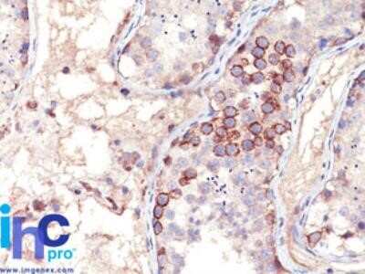 Immunohistochemistry-Paraffin: MAGEA1 Antibody (MA454) - Azide and BSA Free [NBP2-33094]