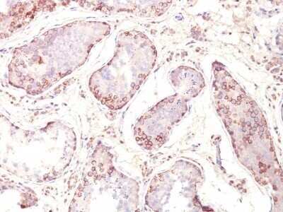 Immunohistochemistry-Paraffin: MAGEA1 Antibody (MZ2E/838) - IHC-Prediluted [NBP2-48165]