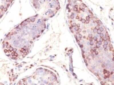 Immunohistochemistry-Paraffin: MAGEA1 Antibody (SPM282) - Azide and BSA Free [NBP2-34754]