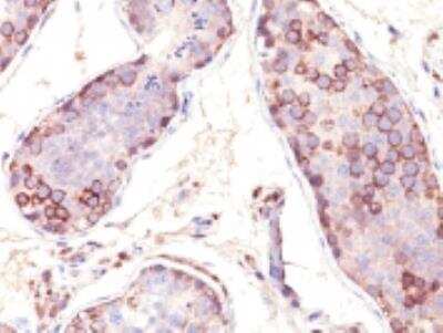 Immunohistochemistry-Paraffin: MAGEA1 Antibody (SPM282) [NBP2-32871]